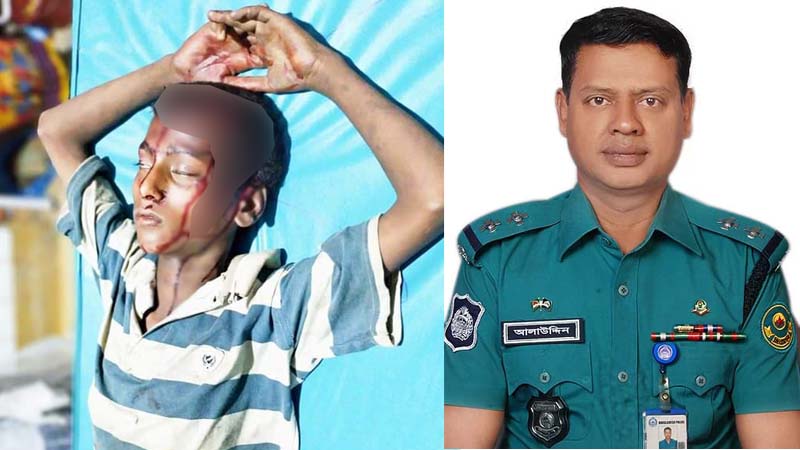 পথকিশোরের চিকিৎসা দায়িত্ব নিলেন এস আই আলাউদ্দীন