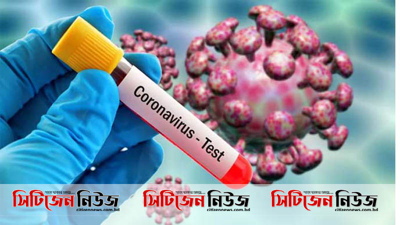 চট্টগ্রামে ২৬৪ মধ্যে ৬৫ জনের করোনা শনাক্ত