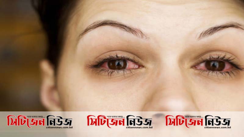 চোখে ২১ দিন পর্যন্ত টিকে থাকে করোনাভাইরাস