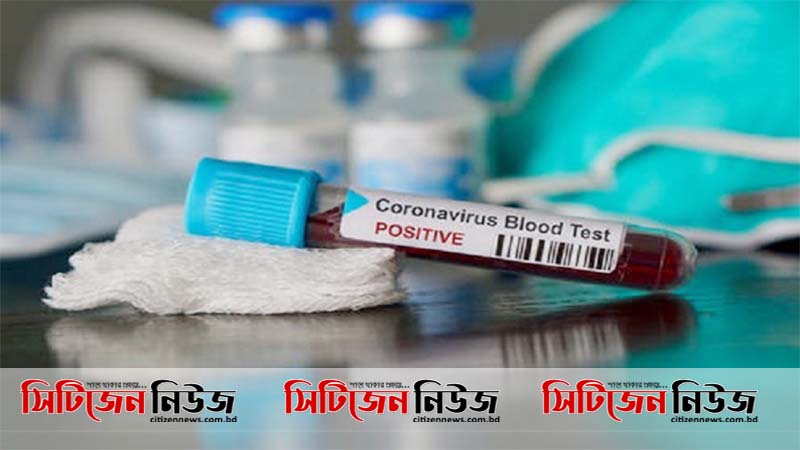 চট্টগ্রামে ৪০৯ নমুনা পরীক্ষায় পজিটিভ ১১৮জনের