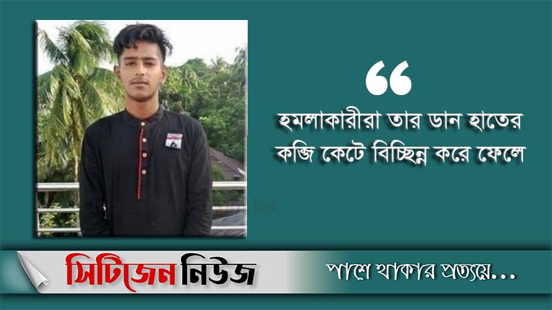 রাতের আঁধারে ছাত্রলীগ নেতার হাতের কব্জি কর্তন
