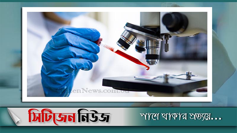 অক্সফোর্ডের টিকা নিয়ে প্রাণ গেল স্বেচ্ছাসেবকের