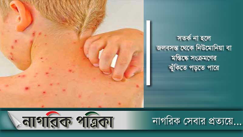 জলবসন্তকে অবহেলা নয়, সতর্ক থাকার পরামর্শ